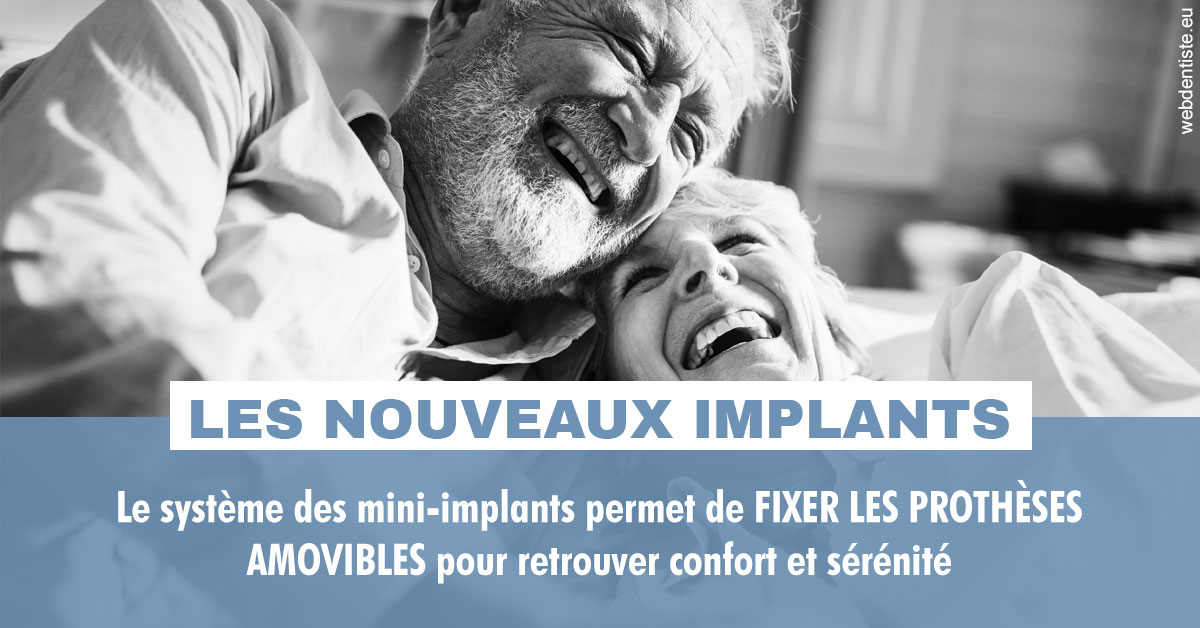 https://www.orthodontie-allouch-et-associes.fr/Les nouveaux implants 2
