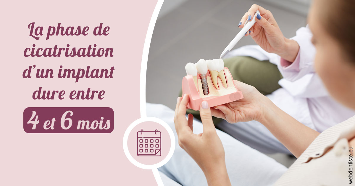 https://www.orthodontie-allouch-et-associes.fr/Cicatrisation implant 2