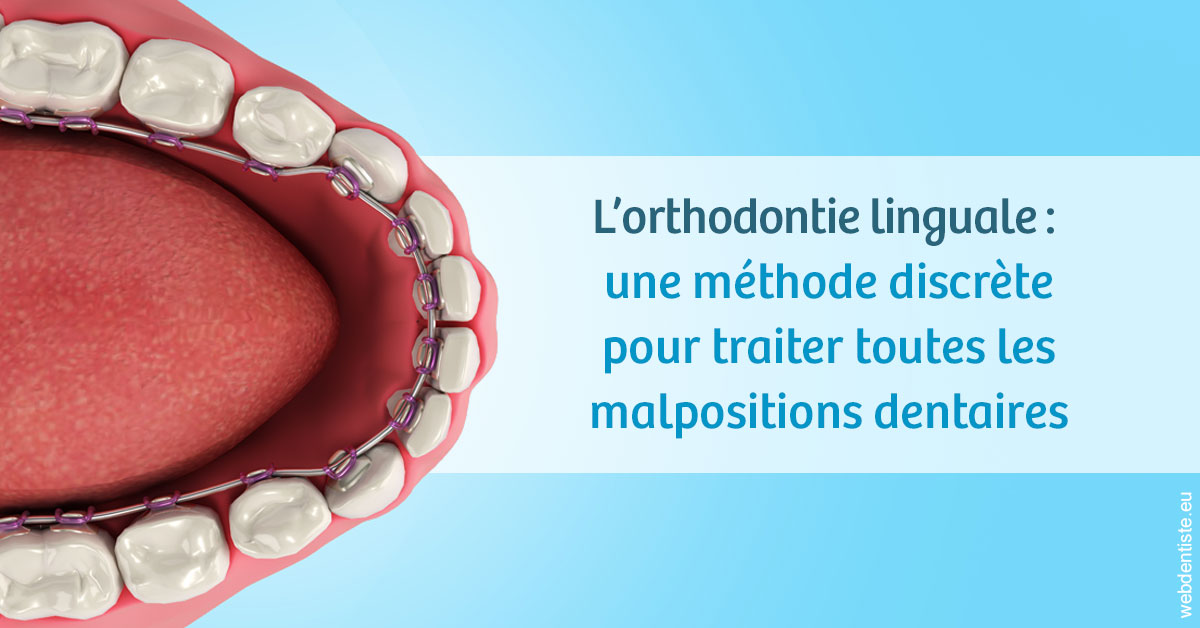 https://www.orthodontie-allouch-et-associes.fr/L'orthodontie linguale 1