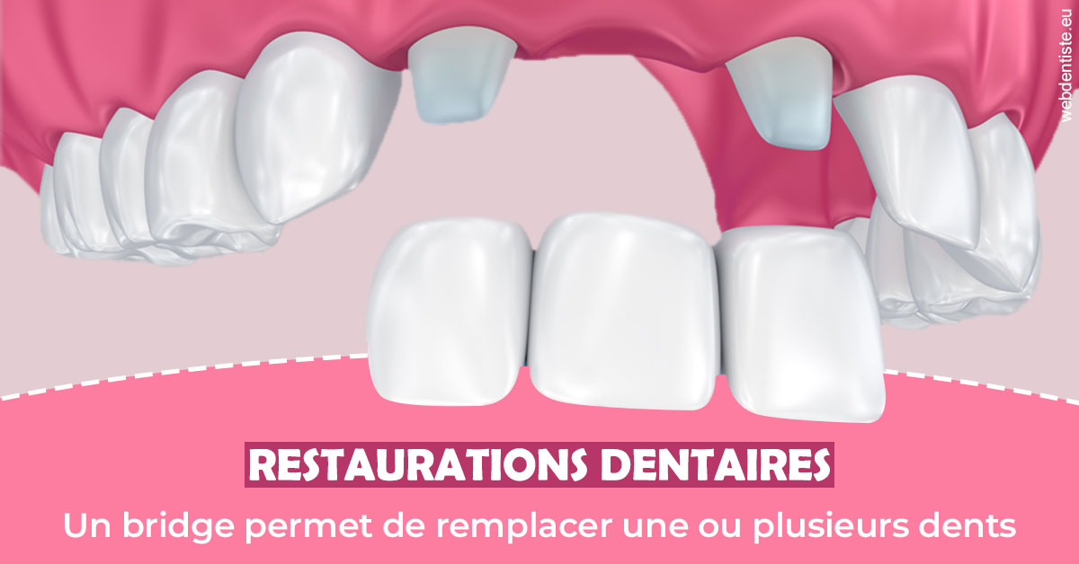 https://www.orthodontie-allouch-et-associes.fr/Bridge remplacer dents 2