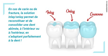 https://www.orthodontie-allouch-et-associes.fr/L'INLAY ou l'ONLAY