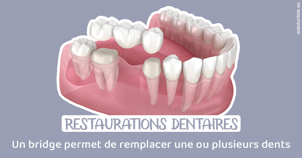 https://www.orthodontie-allouch-et-associes.fr/Bridge remplacer dents 1