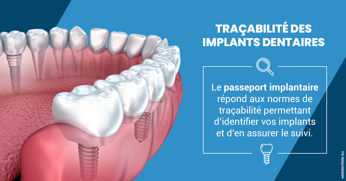 https://www.orthodontie-allouch-et-associes.fr/T2 2023 - Traçabilité des implants 1