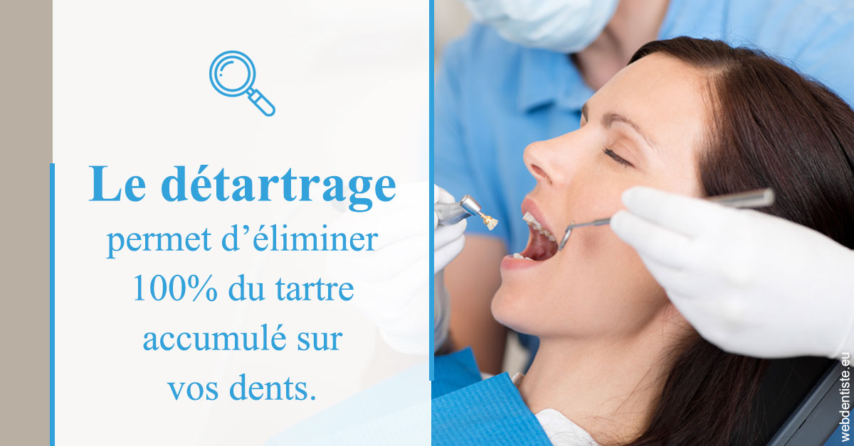 https://www.orthodontie-allouch-et-associes.fr/En quoi consiste le détartrage