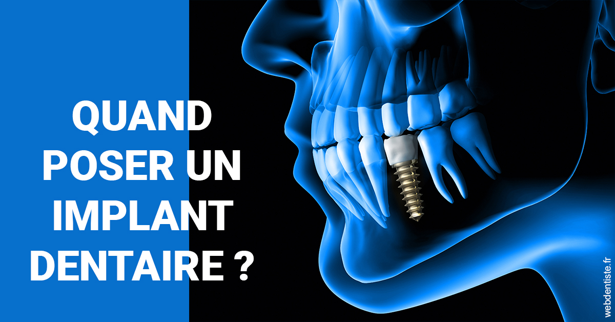 https://www.orthodontie-allouch-et-associes.fr/Les implants 1