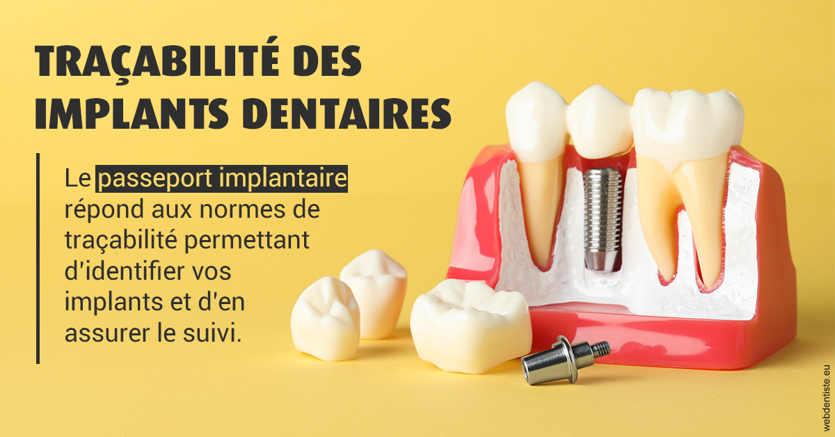 https://www.orthodontie-allouch-et-associes.fr/T2 2023 - Traçabilité des implants 2