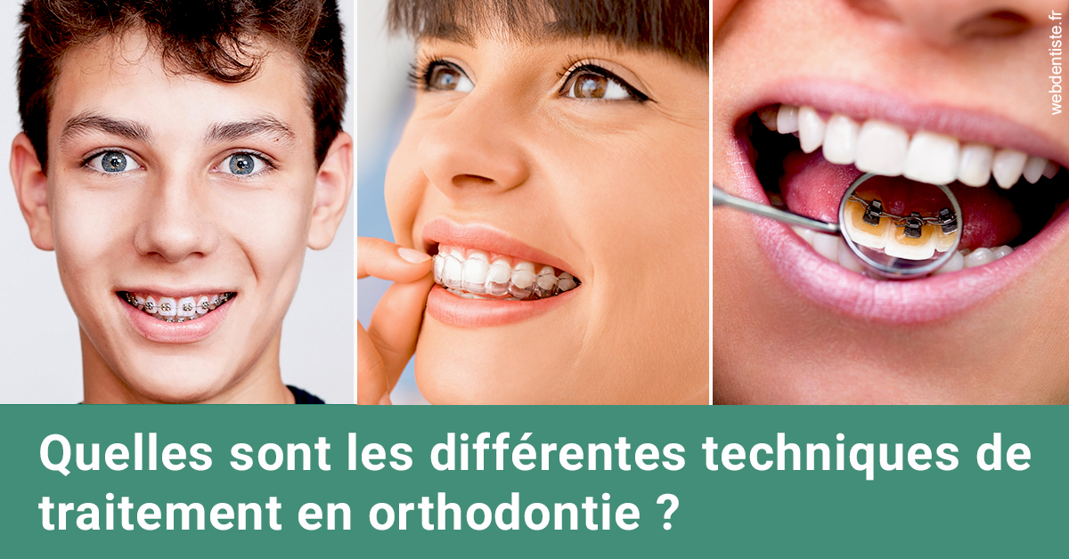 https://www.orthodontie-allouch-et-associes.fr/Les différentes techniques de traitement 2