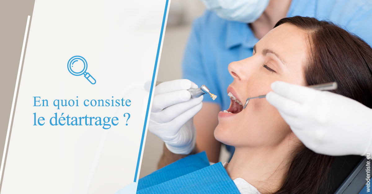 https://www.orthodontie-allouch-et-associes.fr/En quoi consiste le détartrage