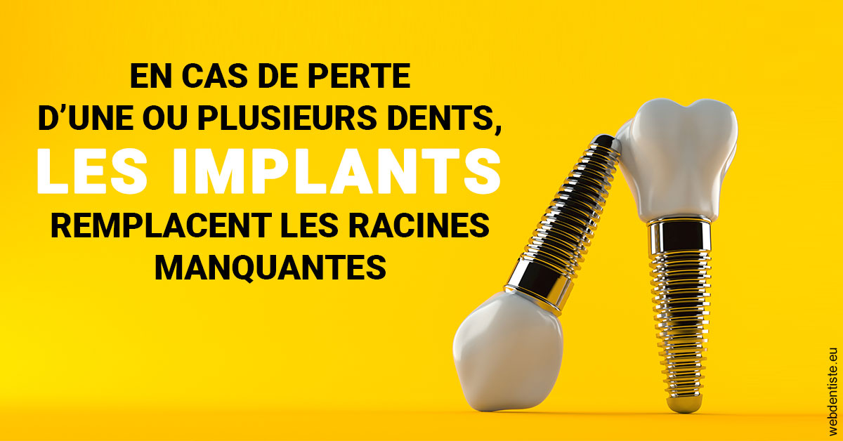 https://www.orthodontie-allouch-et-associes.fr/Les implants 2