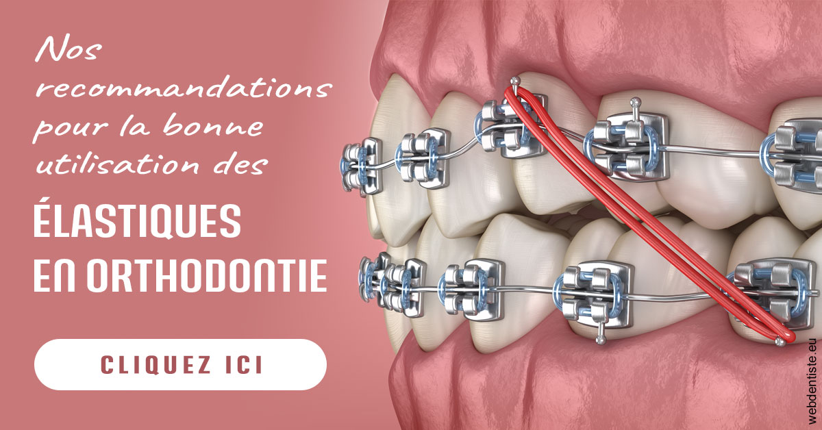 https://www.orthodontie-allouch-et-associes.fr/Elastiques orthodontie 2